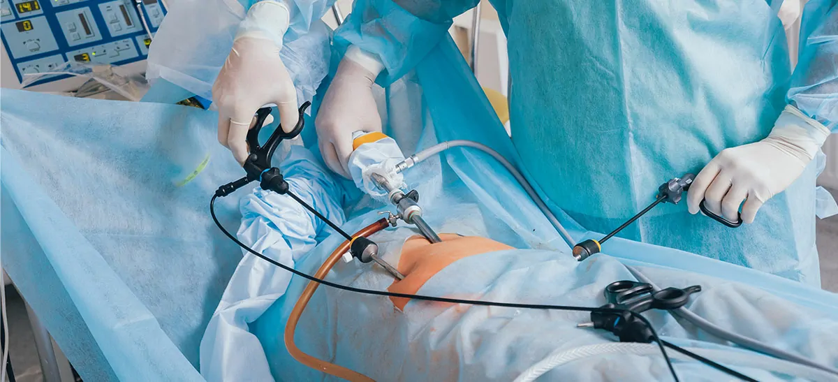 Laparoscopy surgery hospital in jayanagar 7th block